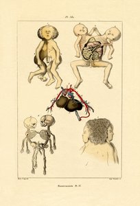 Freak by French School